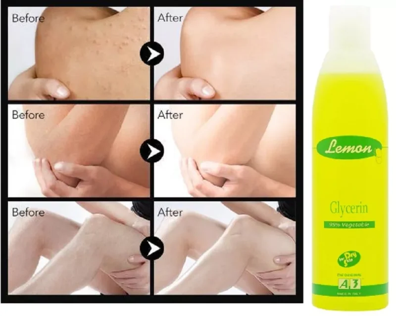 Lemon Glycerin Topical For Dry Skin - Image 7