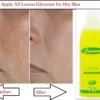 Lemon Glycerin Topical For Dry Skin - Image 5