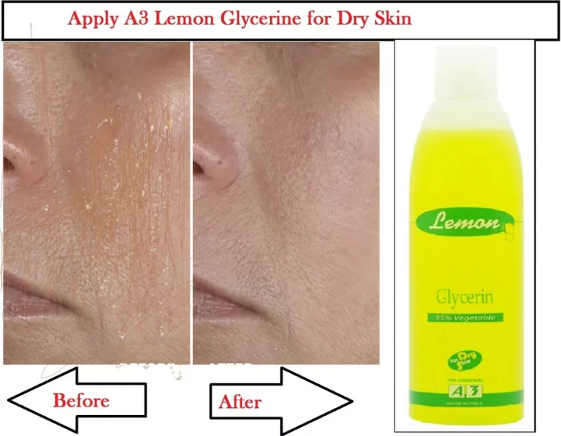 Lemon Glycerin Topical For Dry Skin - Image 5