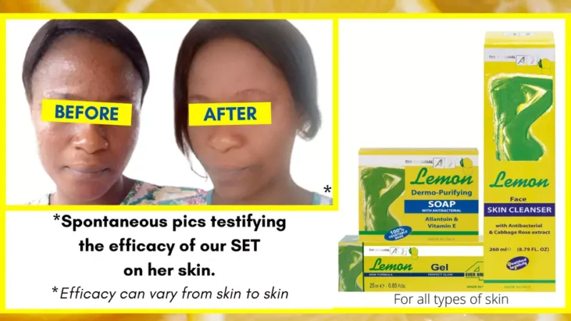 Lemon Dermo-Purifying Soap | Acne Prone Skin | 100g & 200g - Image 3