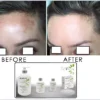 Mandelic Acid & Aloe Vera | Clear Action System - Image 3
